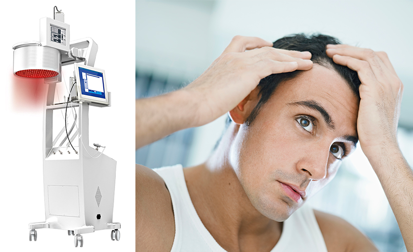 Laser Hair Loss Therapy & Treatment - Toronto - Nature Hair Centres