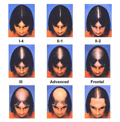 The Ludwig Scale